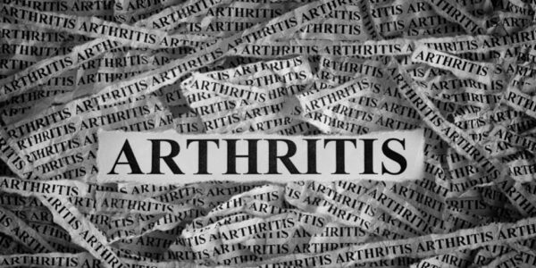 Arthritis Different Conditions