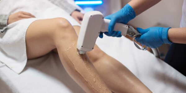 Laser Hair Removal Treatment