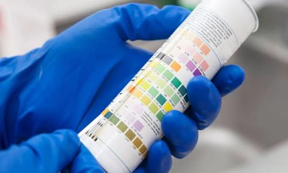 Improving Sample Awareness Through Detailed Urine Testing Information and Proper Handling Practices